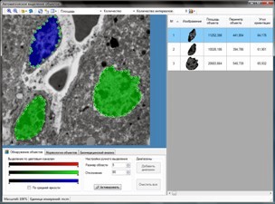 SEO-TEM2