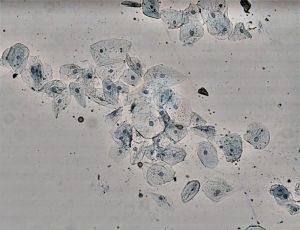After flat-field correction