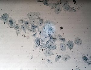 Before flat-field correction